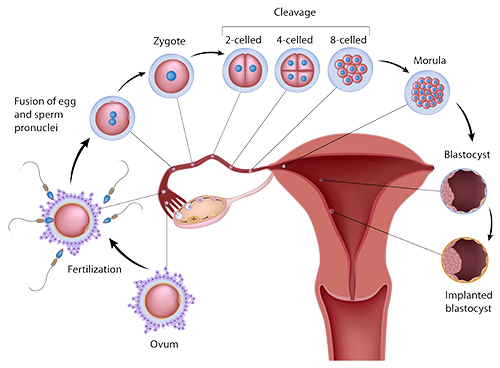 ICSI Treatment